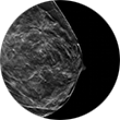 3D Mammography Image