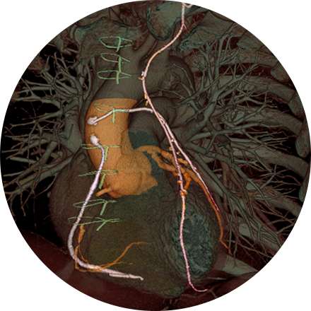 Chest Imaging Image