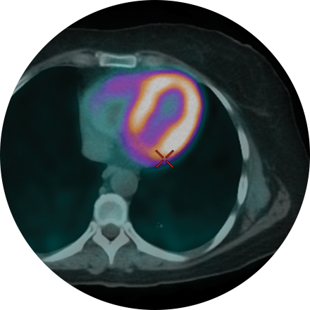 PET/CT Image