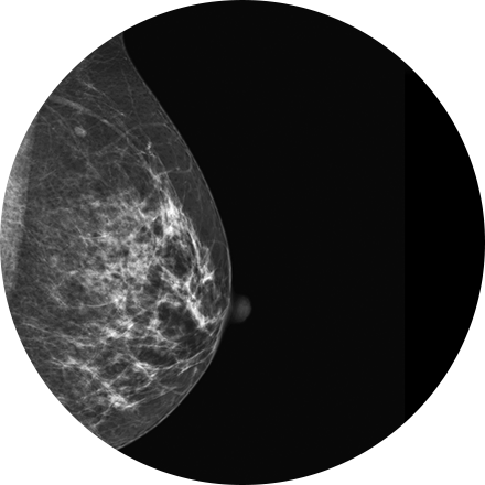 Women’s Imaging Image