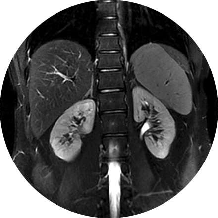 Abdominal Imaging Image