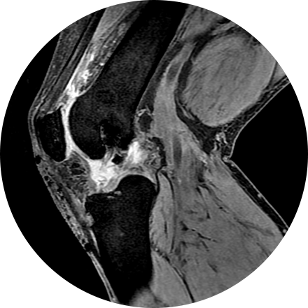 Musculoskeletal Imaging Image